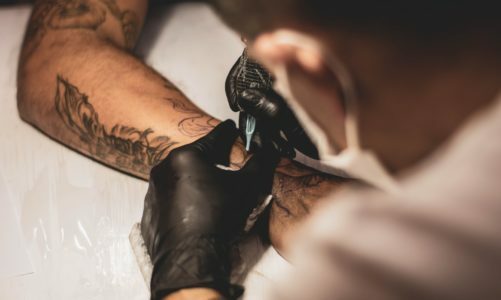 How the Tattoo Removal Process Works